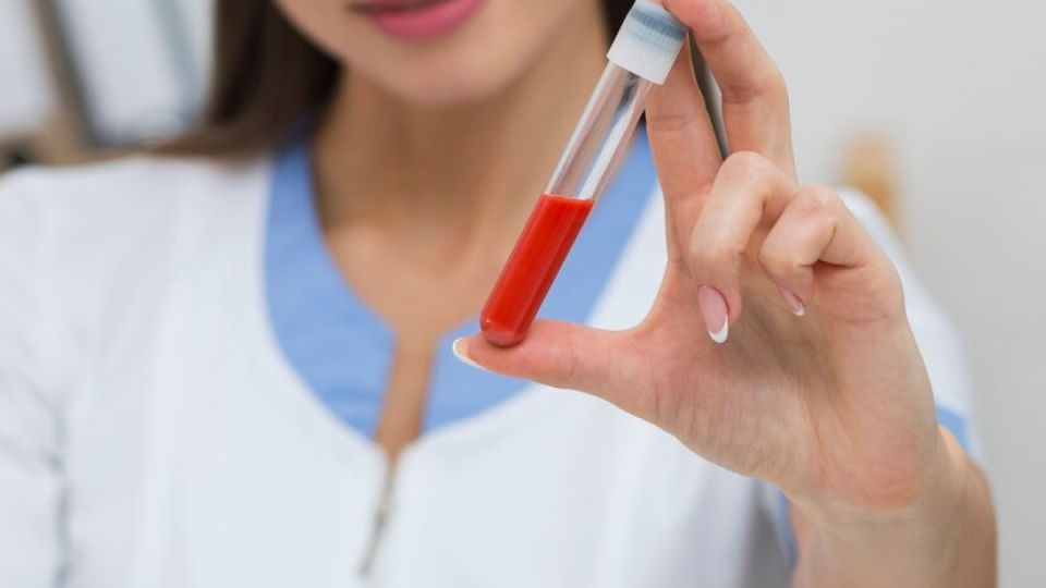 Как предотвратить сгущение крови после 50: 5 продуктов-помощников Как предотвратить сгущение крови после 50: 5 продуктов-помощников